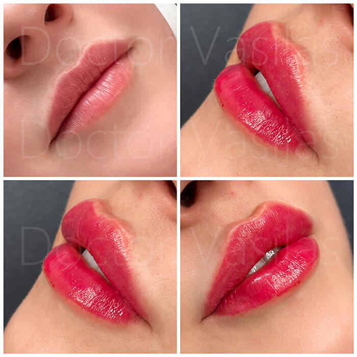 lips-2